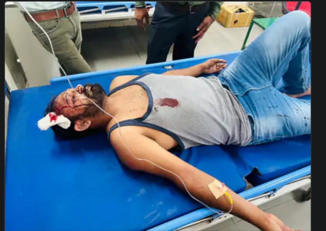 Angry father got his son-in-law attacked because his daughter got  love marriage